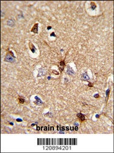 PRDX6 Antibody
