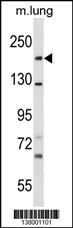 SNED1 Antibody