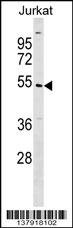 UBE2Q1 Antibody