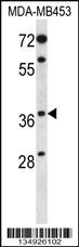 PAQR8 Antibody