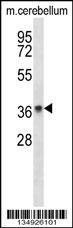 PAQR8 Antibody