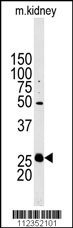 STC2 Antibody