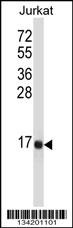 TAC3 Antibody