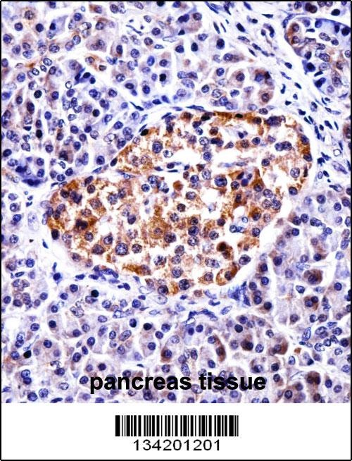 TAC3 Antibody