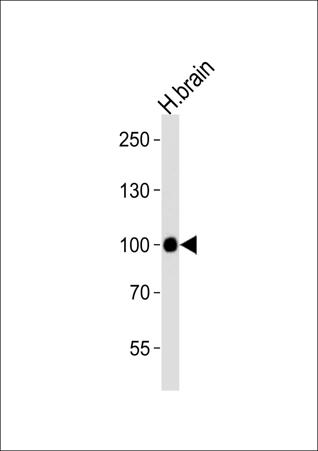 CDH13 Antibody