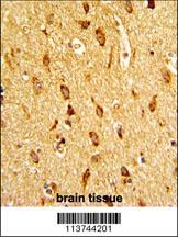 CDH13 Antibody