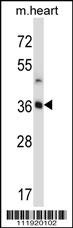 STC2 Antibody