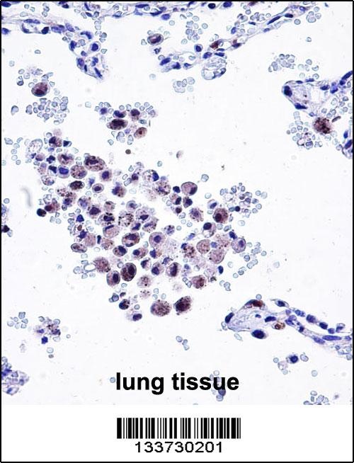 ARHGDIB Antibody