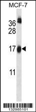UBE2W Antibody