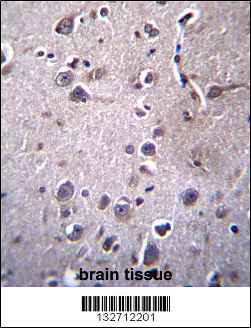 ITM2B Antibody