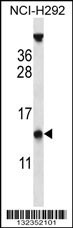 PYDC1 Antibody