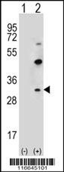 CLDN2 Antibody