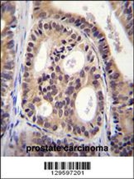 SPECC1L Antibody