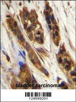 SNRNP27 Antibody