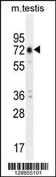 ANKEF1 Antibody
