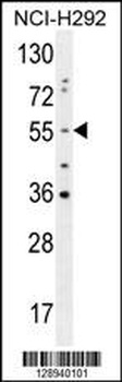 OTUD1 Antibody