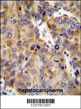 COL18A1 Antibody