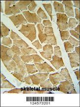 ARHGAP10 Antibody