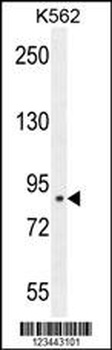 CLIC6 Antibody