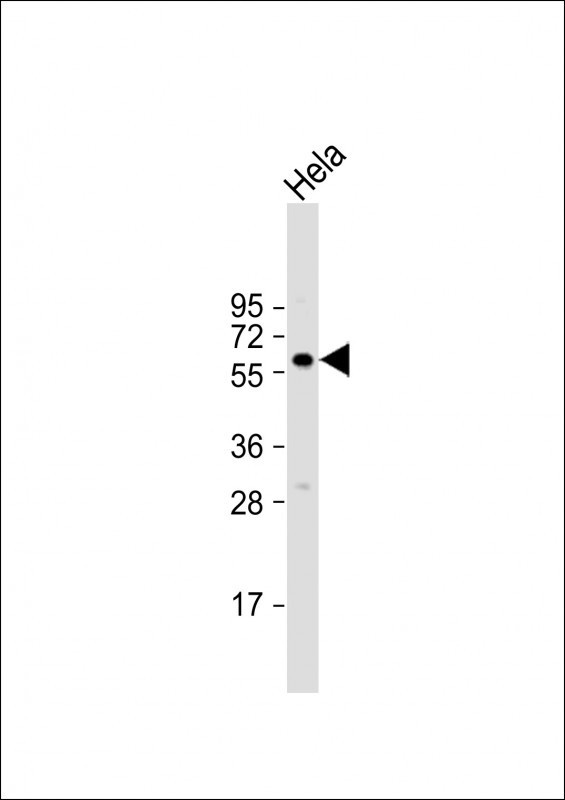 BMPR1A Antibody