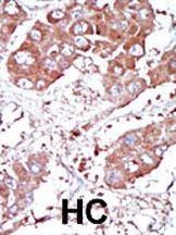 BMPR1A Antibody