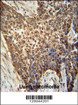 METTL4 Antibody