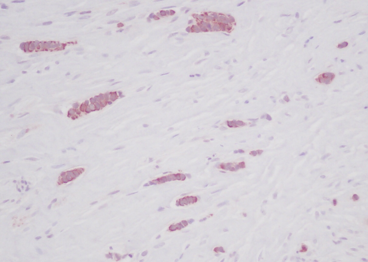 CCL5 Antibody