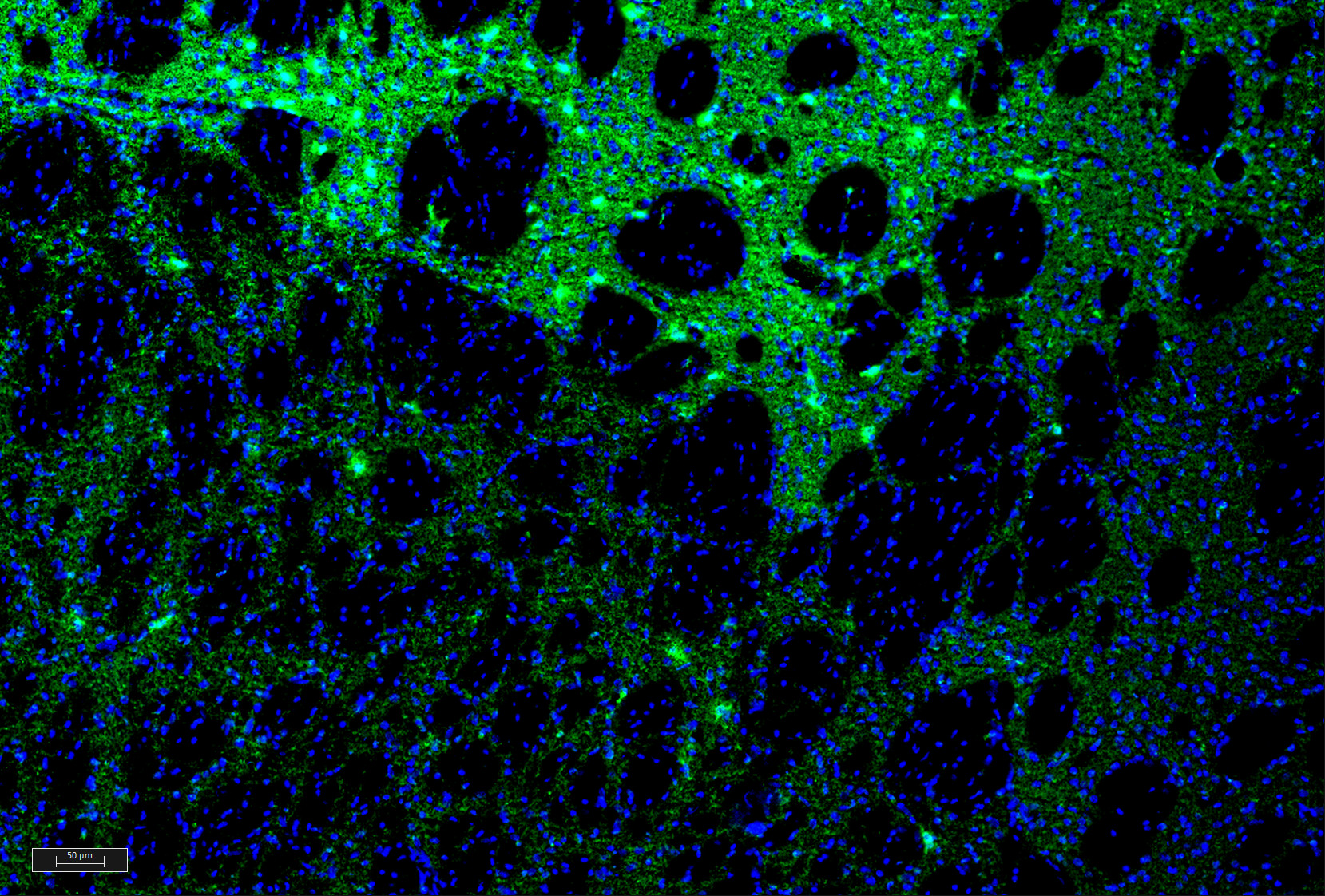 Ccl2 Antibody