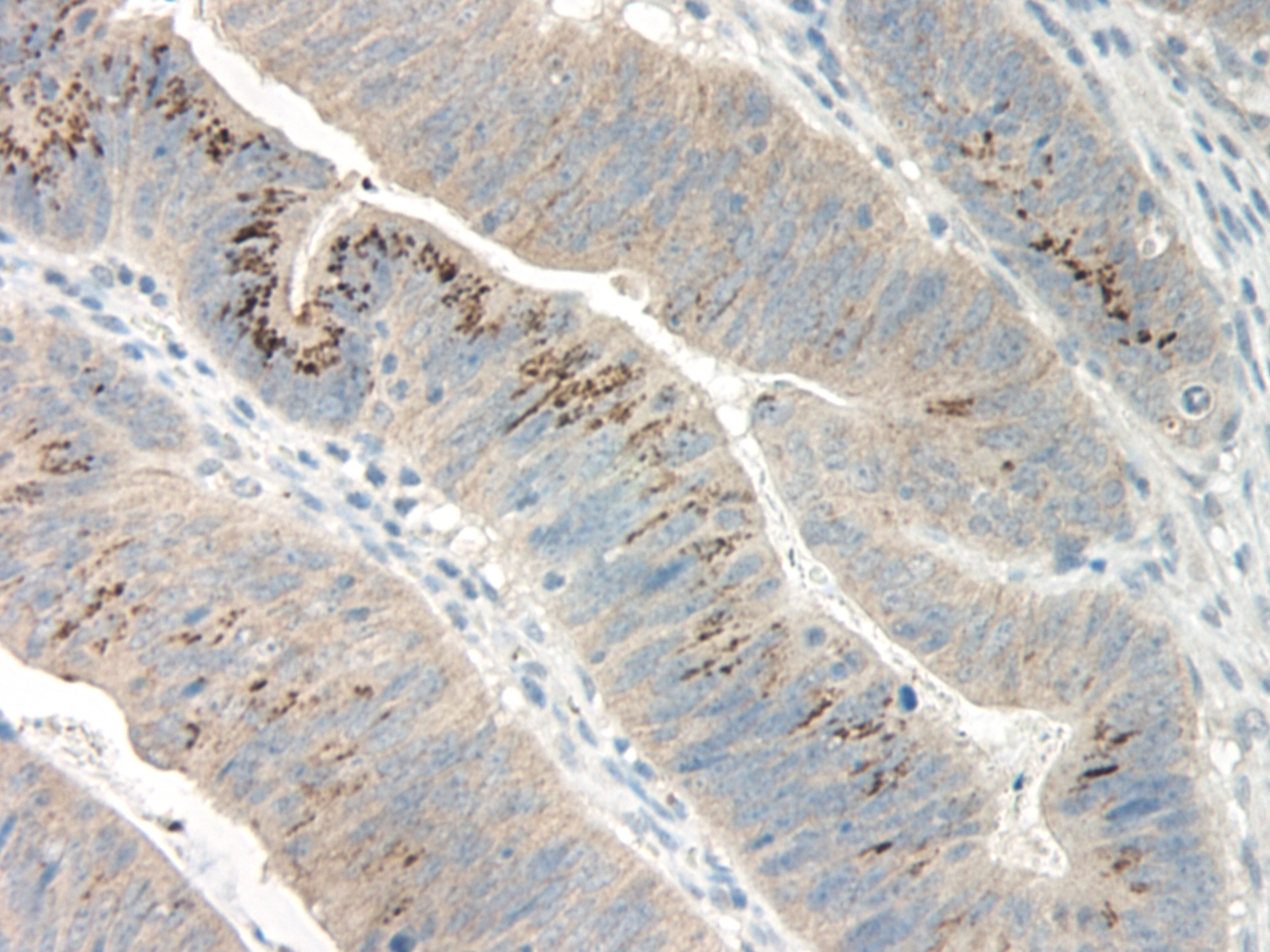 CXCL3 Antibody