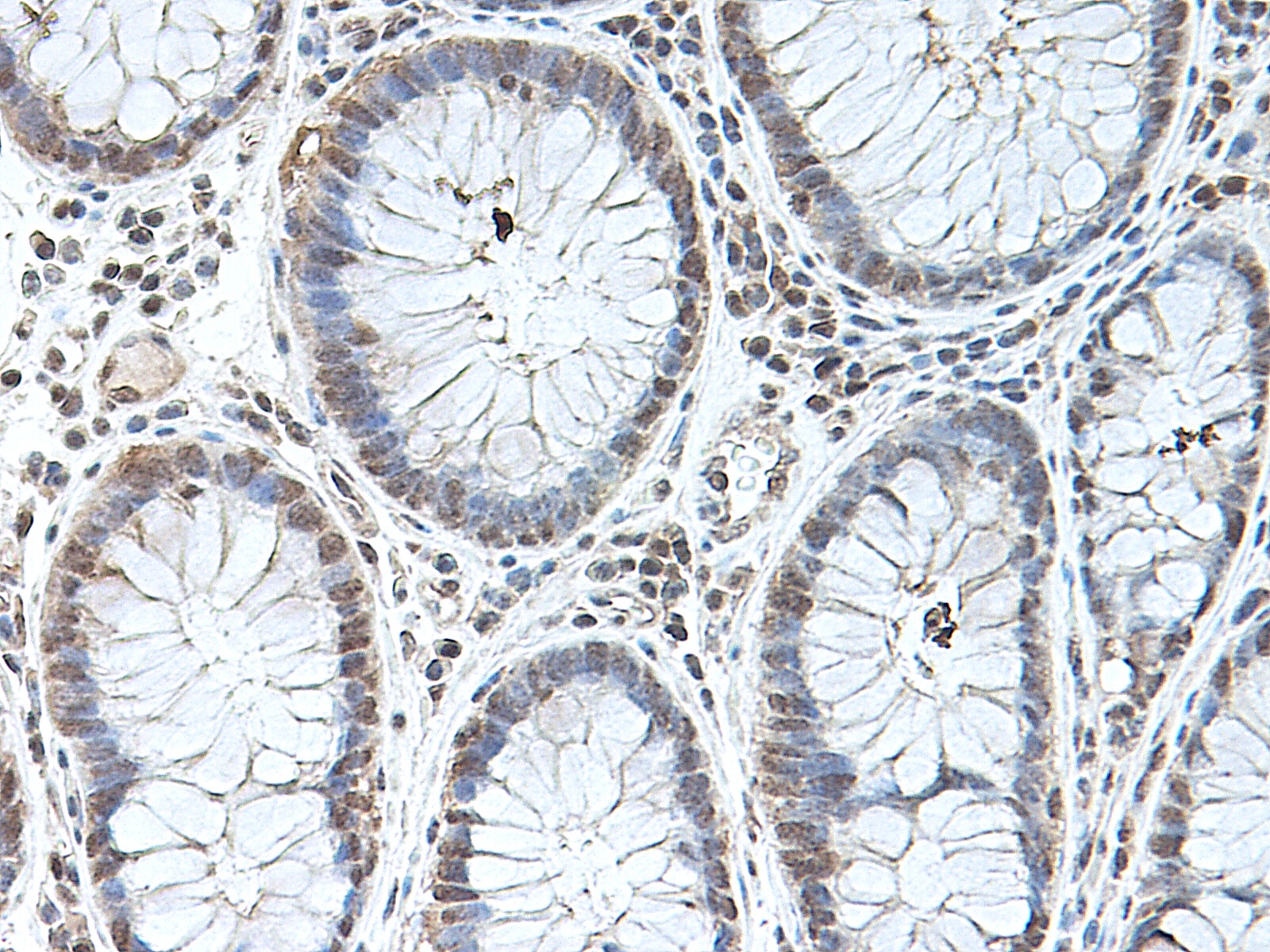BMP2 Antibody