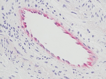 COL18A1 Antibody