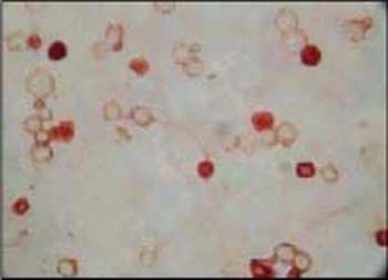 ORF62 Antibody