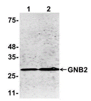 GNB2 Antibody