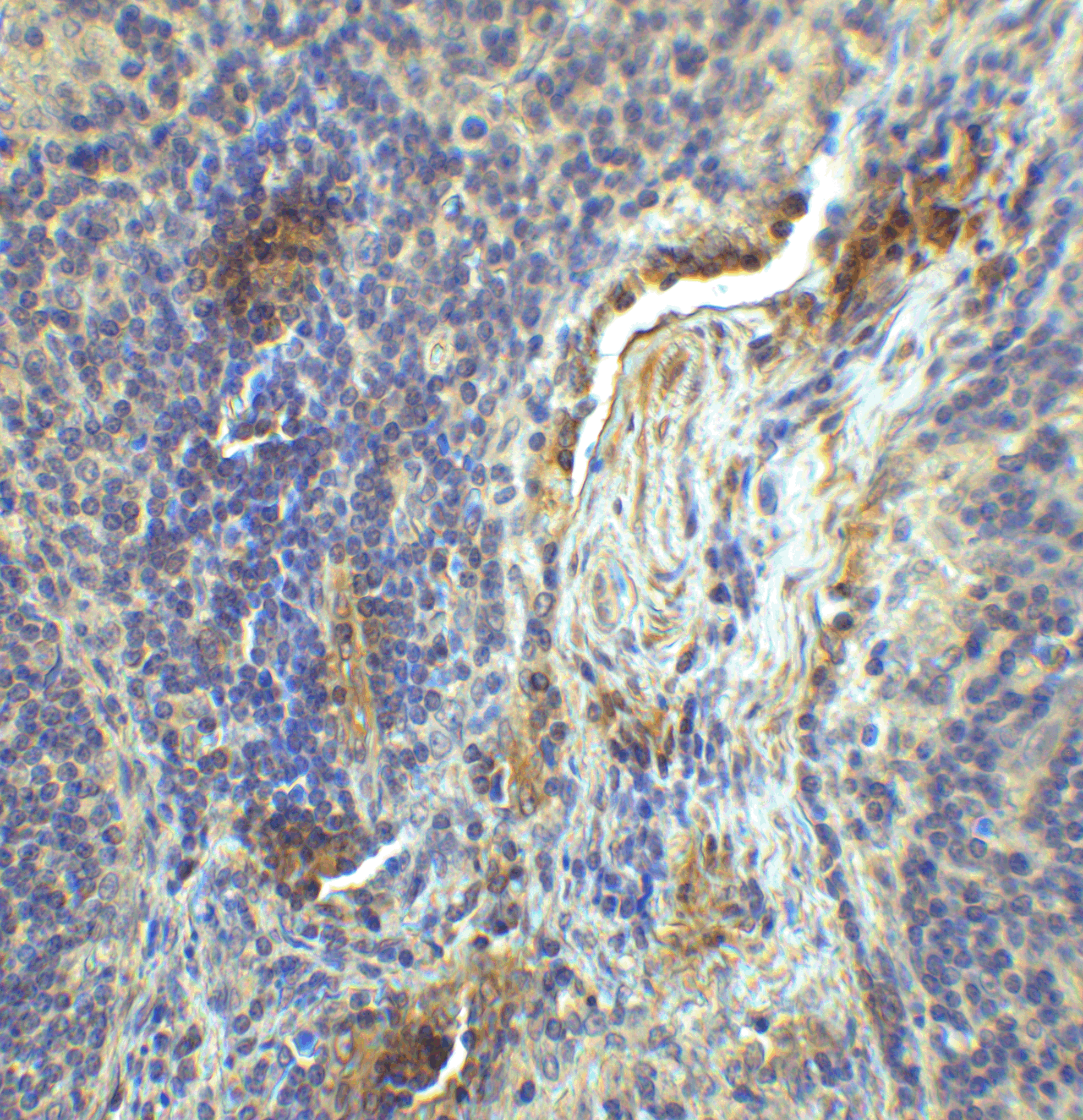 LAG3 Antibody