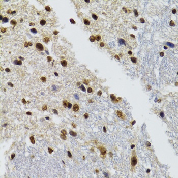BAZ1B Antibody