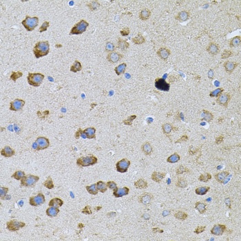 PFKP Antibody