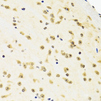 SUZ12 Antibody