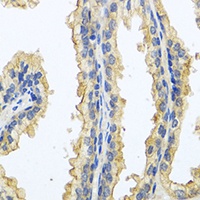 Oncostatin M Rabbit Polyclonal Antibody