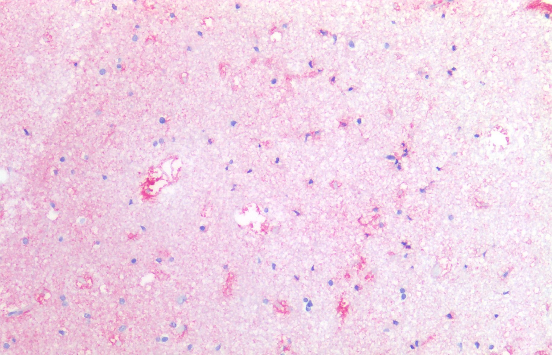 CD142 Antibody