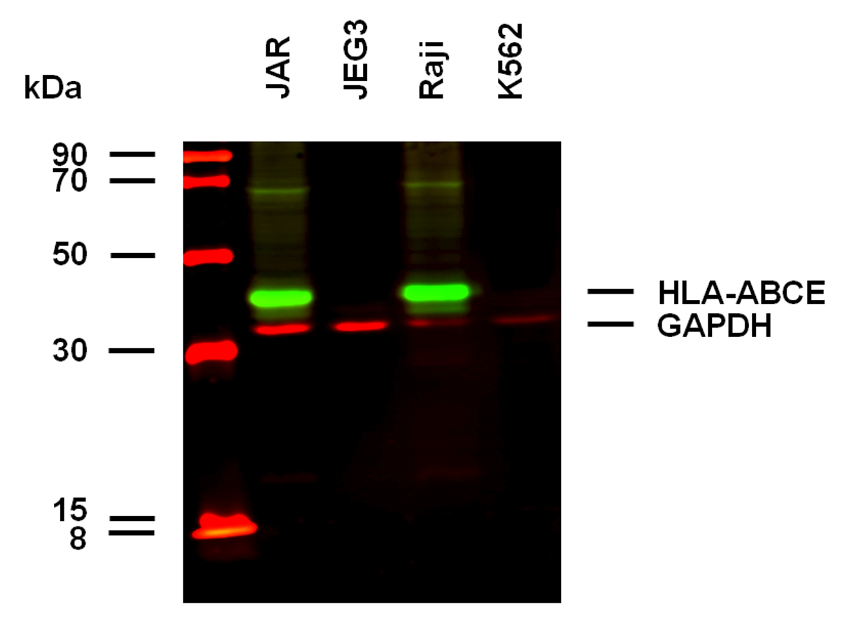 HLA-ABCE Antibody