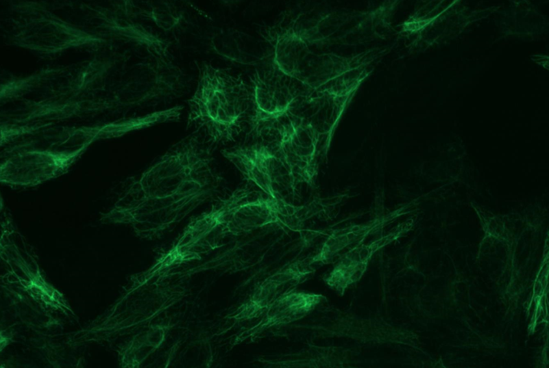 Cytokeratin 8 Antibody