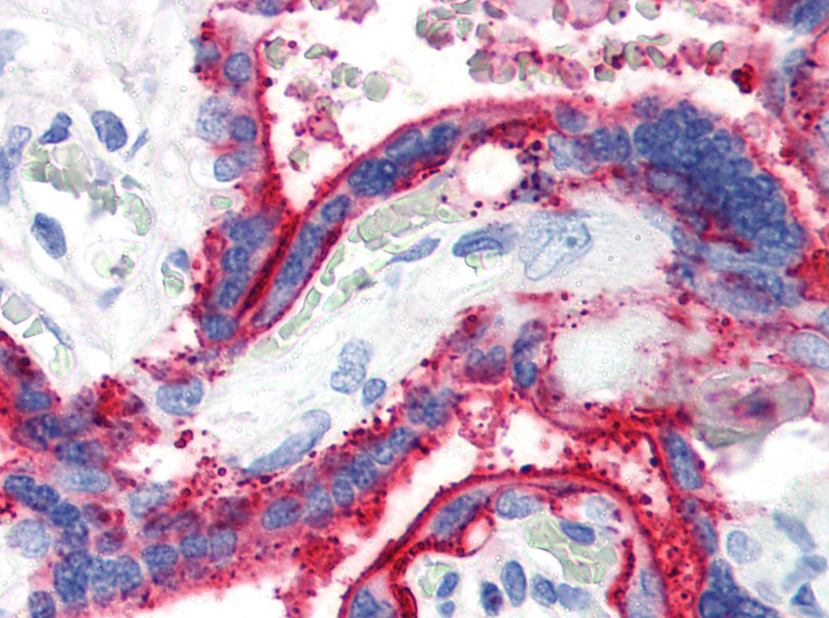 CD59 Antibody