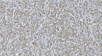 Aryl hydrocarbon Receptor/AHR Rabbit Polyclonal Antibody
