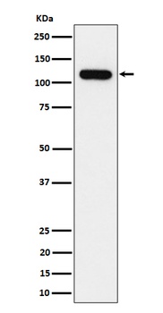 NOLC1 Rabbit Monoclonal Antibody