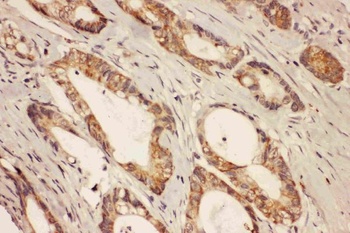 Ras-related protein Rab-8A RAB8A/8A Rabbit Polyclonal Antibody
