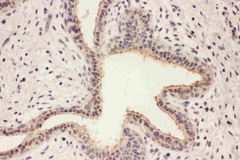 Ras-related protein Rab-8A RAB8A/8A Rabbit Polyclonal Antibody