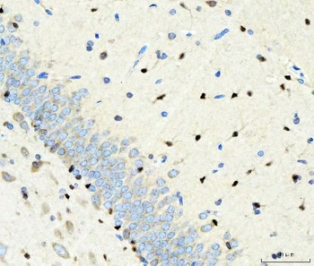 Transcription factor SOX-2 SOX2/SOX Rabbit Polyclonal Antibody