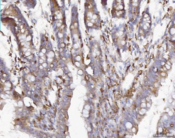 COX1/Cyclooxygenase 1/PTGS1 Rabbit Polyclonal Antibody