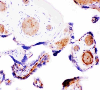 Wnt5a Rabbit Polyclonal Antibody