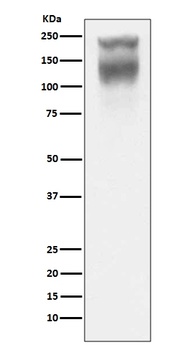CEA CEACAM5 Rabbit Monoclonal Antibody
